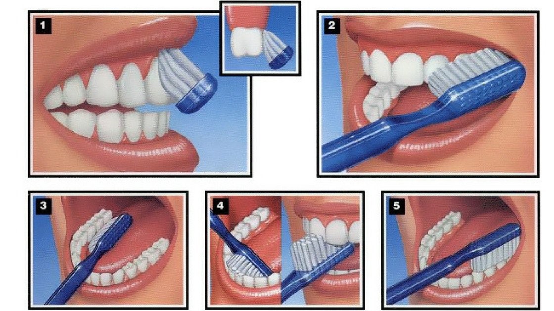 Cách đánh răng đúng cách
